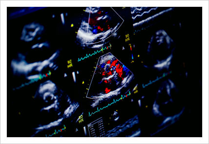 An echocardiogram is showing various x-ray images of the heart.