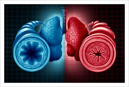 An image of bronchial tubes